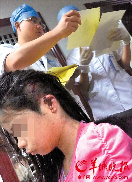 受傷的11歲女孩頭發(fā)被卷入扶梯，耳朵被嚴(yán)重拉傷，需手術(shù)。