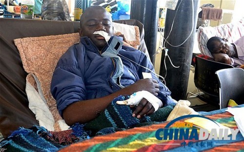 雖然已經(jīng)在醫(yī)院接受了近一個月的恢復(fù)治療，卡托卡的身體仍然非常虛弱。