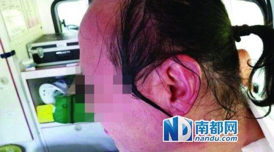 涉事教師遭熱水潑臉后的照片。