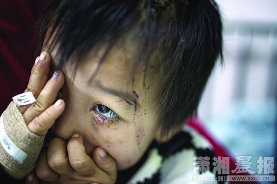 1月13日，湖南省兒童醫(yī)院，4歲的源源用手蒙住了眼睛。