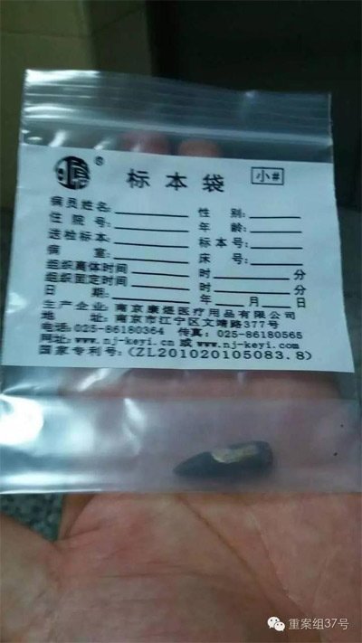 經(jīng)警方鑒定，秦女士體內(nèi)取出的子彈系56式步槍射出 。 受訪者供圖