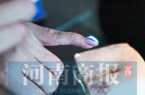 將指甲油涂在指甲上，靠近火焰時(shí)被引燃了
